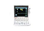 Color Doppler Ultrasound System Portable Ultrasound Scanner With 12.1 Inch LED