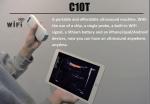 DICOM Medical Hospital Equipments 128 Element Portable Wifi Wireless Ultrasound