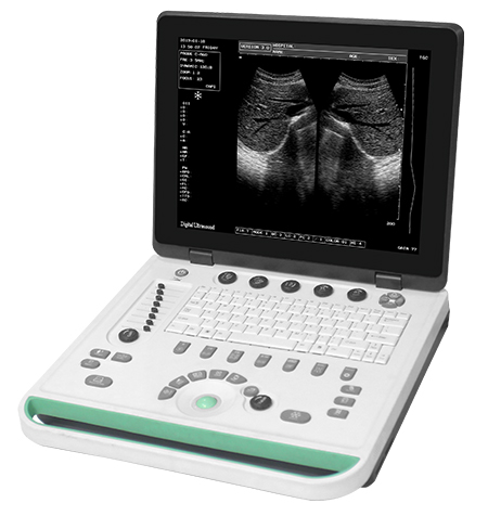 15 inch Cheap Hotsell SS-7 Vet Ultrasound Portable Machine Equipment High Image